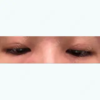9日目の経過画像（2枚目）