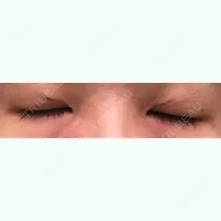 9日目の経過画像（3枚目）