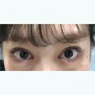 14日目の経過画像（3枚目）