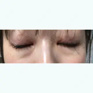 16日目の経過画像（1枚目）