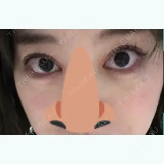 24日目の経過画像（1枚目）