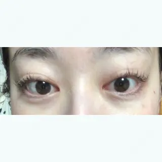 115日目の経過画像（2枚目）