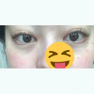 114日目の経過画像（1枚目）