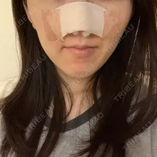 1日目の経過画像（1枚目）