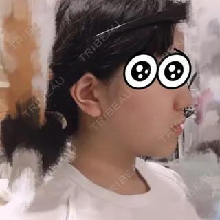 10日目の経過画像（1枚目）