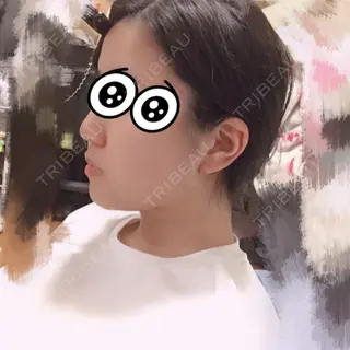 10日目の経過画像（2枚目）