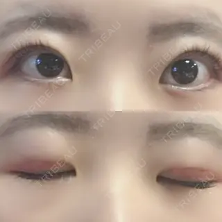 7日目の経過画像（1枚目）