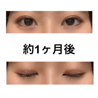 32日目の経過画像（1枚目）
