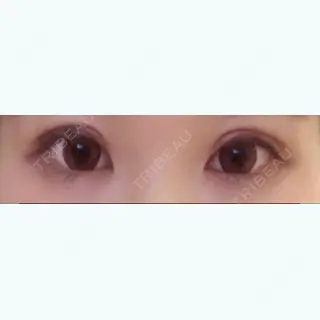 22日目の経過画像（1枚目）