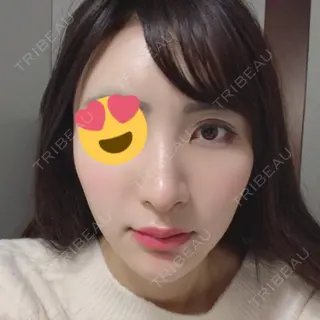 22日目の経過画像（1枚目）