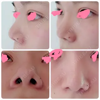 139日目の経過画像（1枚目）
