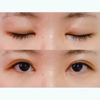 9日目の経過画像（1枚目）