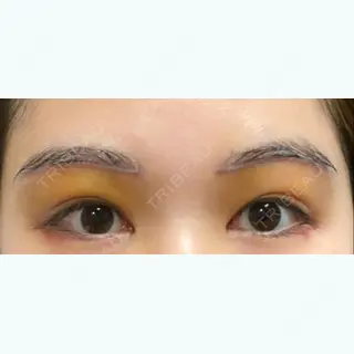 6日目の経過画像（1枚目）