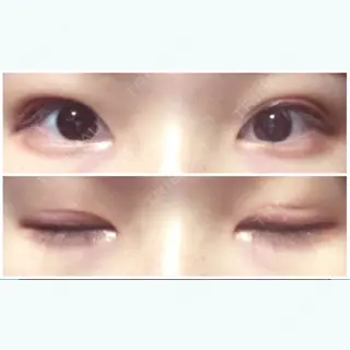 8日目の経過画像（1枚目）