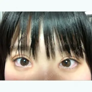 10日目の経過画像（1枚目）