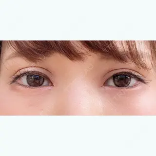10日目の経過画像（2枚目）