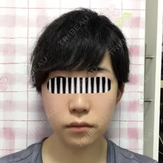 4日目の経過画像（1枚目）