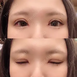 8日目の経過画像（1枚目）