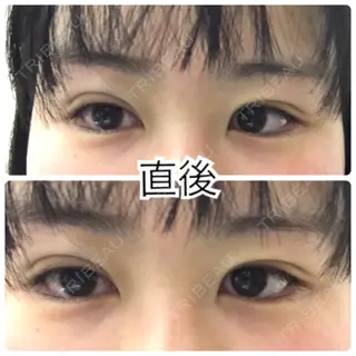 0日目の経過画像（1枚目）