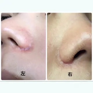 29日目の経過画像（2枚目）