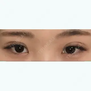 10日目の経過画像（1枚目）