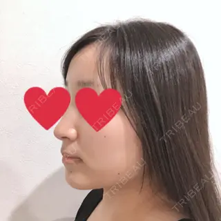 22日目の経過画像（3枚目）
