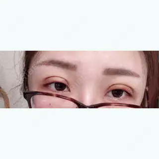 3日目の経過画像（1枚目）