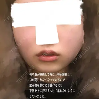 0日目の経過画像（1枚目）