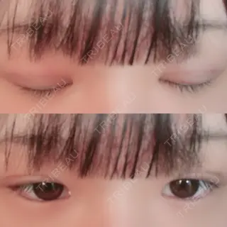 1日目の経過画像（1枚目）