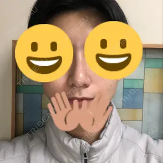 44日目の経過画像（1枚目）