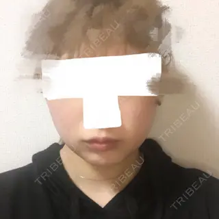 3日目の経過画像（1枚目）