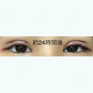 1日目の経過画像（3枚目）