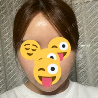 16日目の経過画像（1枚目）