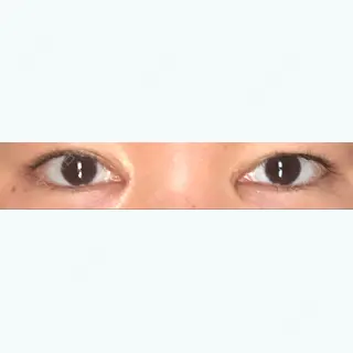 7日目の経過画像（1枚目）