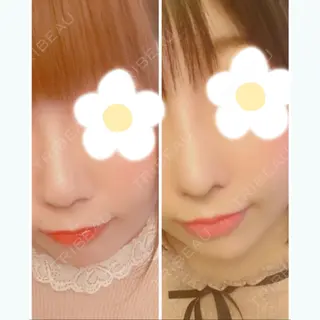 21日目の経過画像（1枚目）