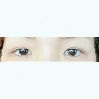 69日目の経過画像（1枚目）