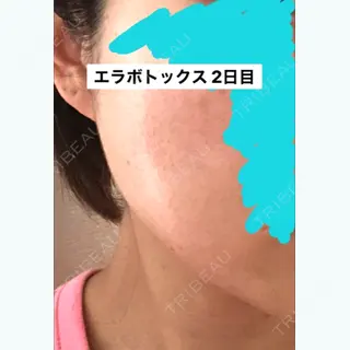 2日目の経過画像（2枚目）