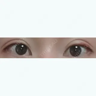 9日目の経過画像（1枚目）