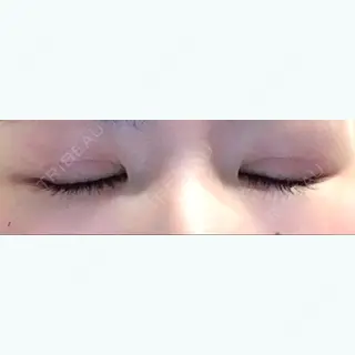 60日目の経過画像（2枚目）
