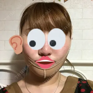 1日目の経過画像（1枚目）