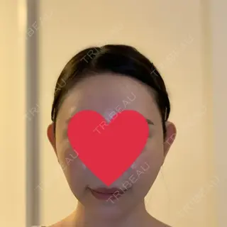 0日目の経過画像（3枚目）