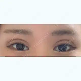 13日目の経過画像（1枚目）