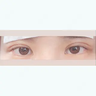2日目の経過画像（1枚目）