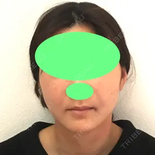 1日目の経過画像（1枚目）