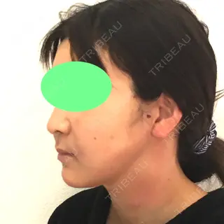 1日目の経過画像（3枚目）
