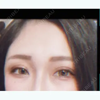 9日目の経過画像（1枚目）