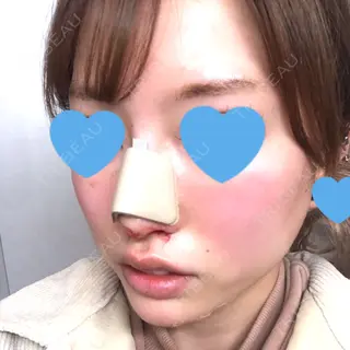 0日目の経過画像（2枚目）