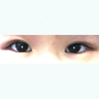 51日目の経過画像（1枚目）