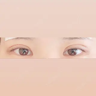 3日目の経過画像（1枚目）