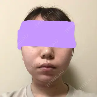 1日目の経過画像（1枚目）